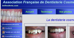 Accueil - Belles Dents.com